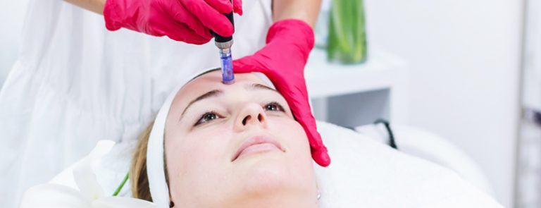 Micro Needling Treatment - Unyozi Beauty - The Best Clinic In Toronto 