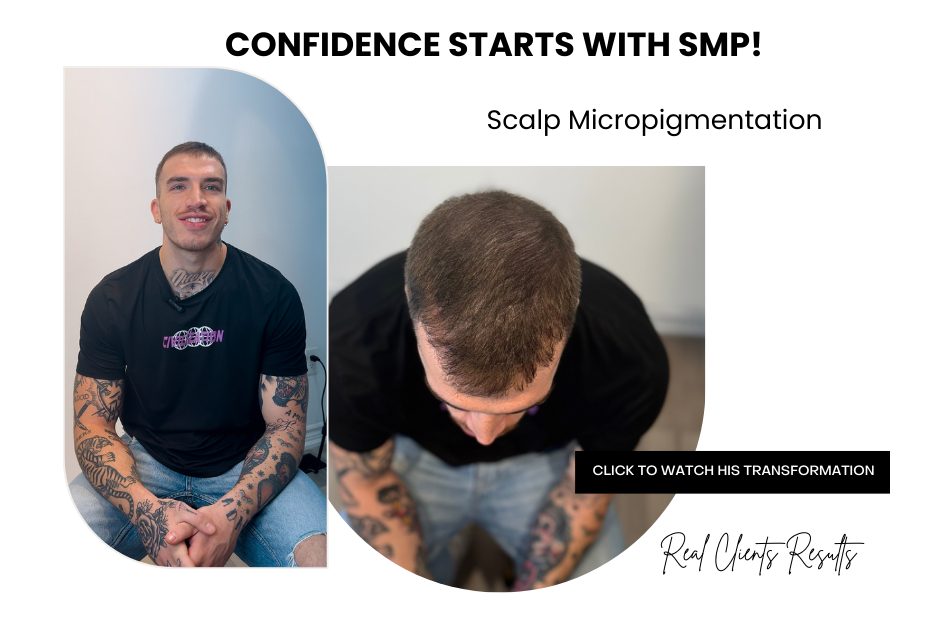 scalp-micropigmentation-Testimonial-Unyozi-Beauty