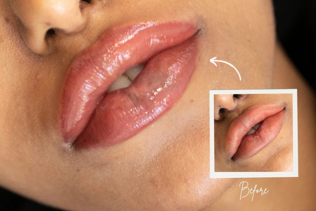 Botched Lip Tattoo Correction Toronto Unyozi Beauty