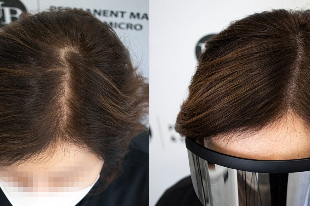 amazing-hair-density-toronto-unyozibeautyjpg