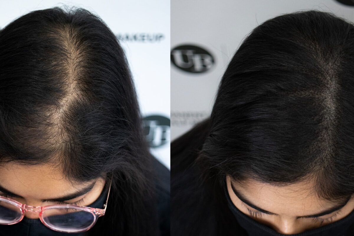 natural-hair-density-transformation-toronto-unyozibeauty